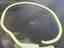 Windscreen