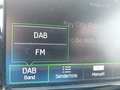 Other optional extras