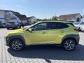 Side view